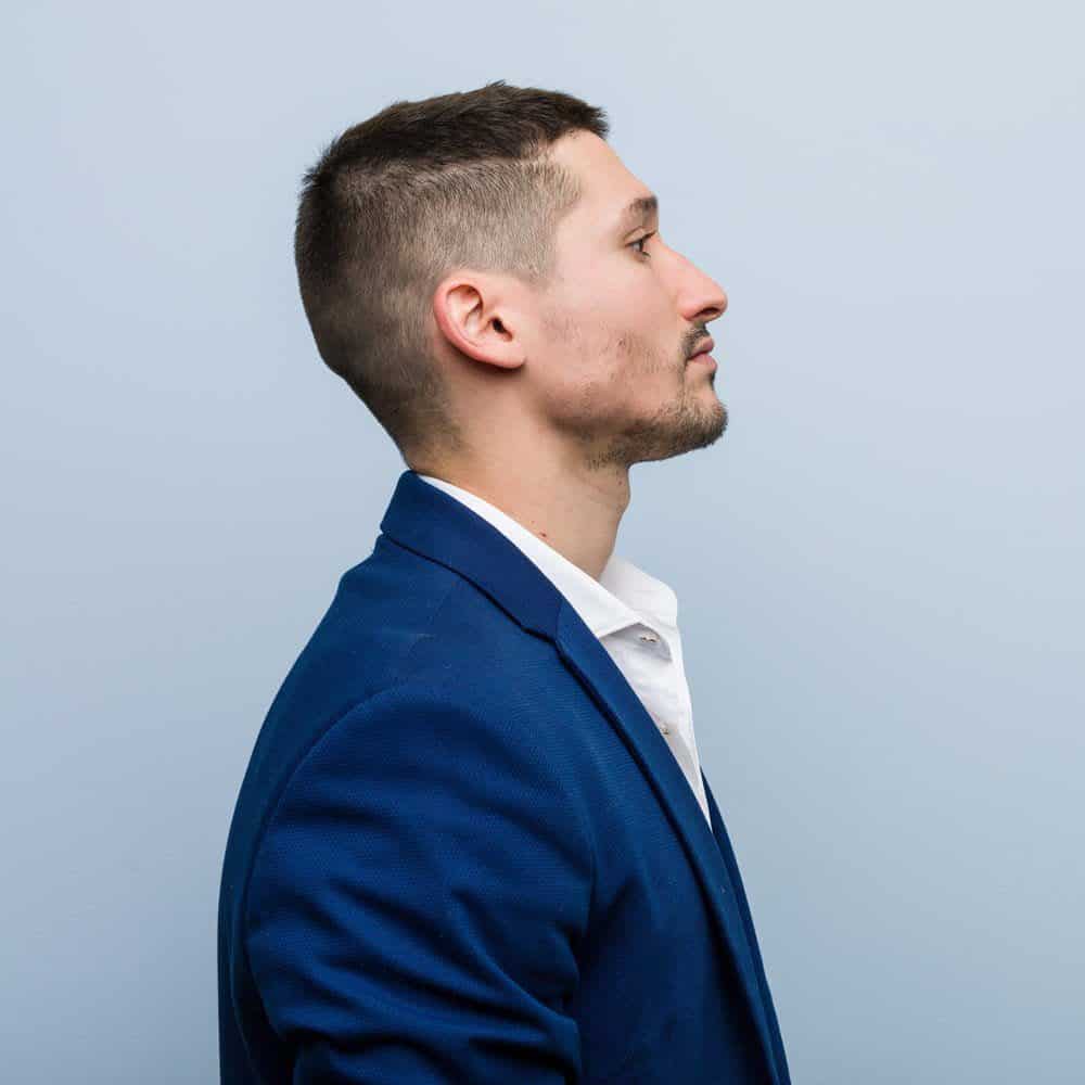 Cirugía estética facial perfil