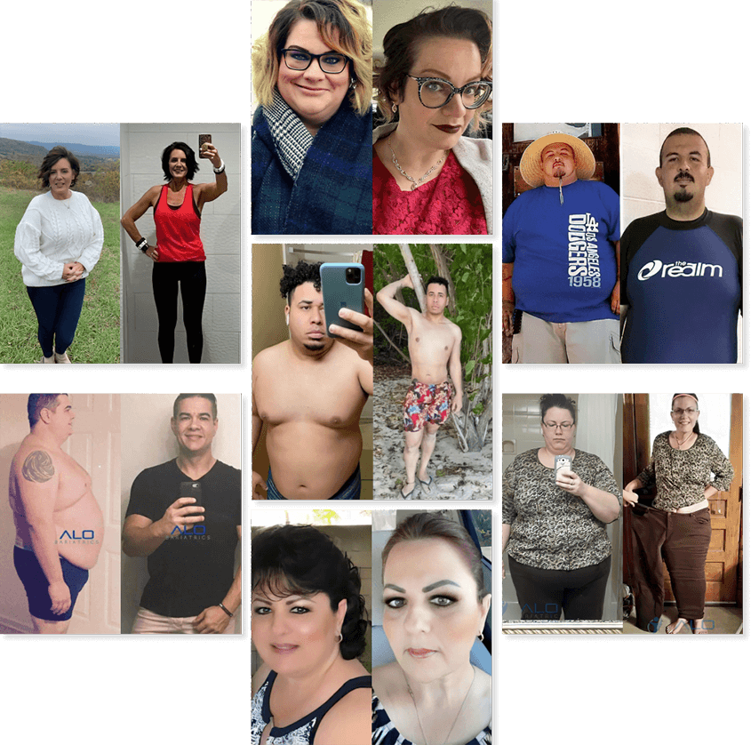 Before and After results