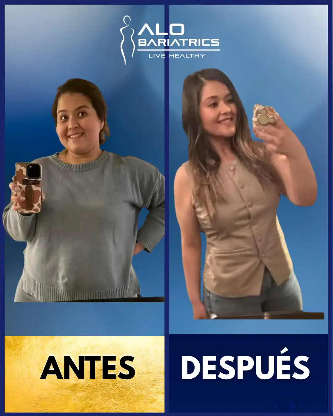 Antes y después cirugía bariátrica