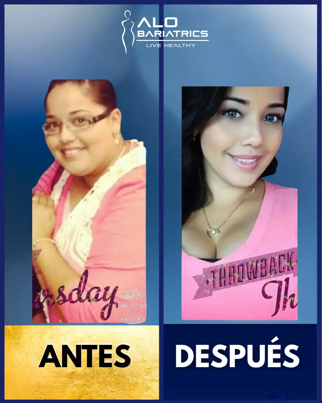Antes y después — paciente ALO Guadalajara