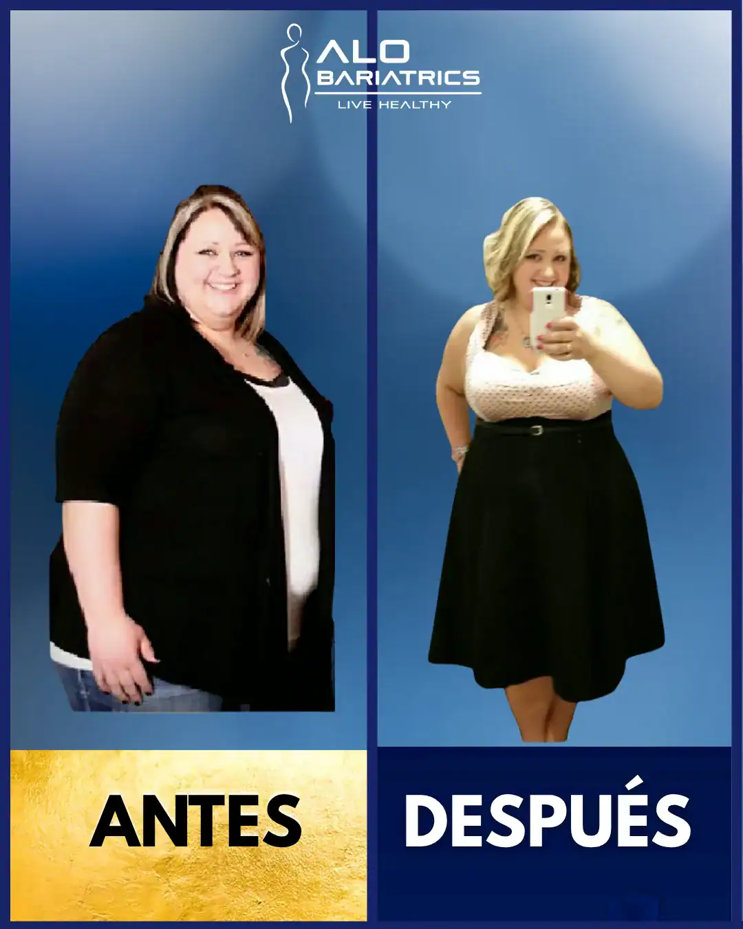 Antes y después — paciente Amanda