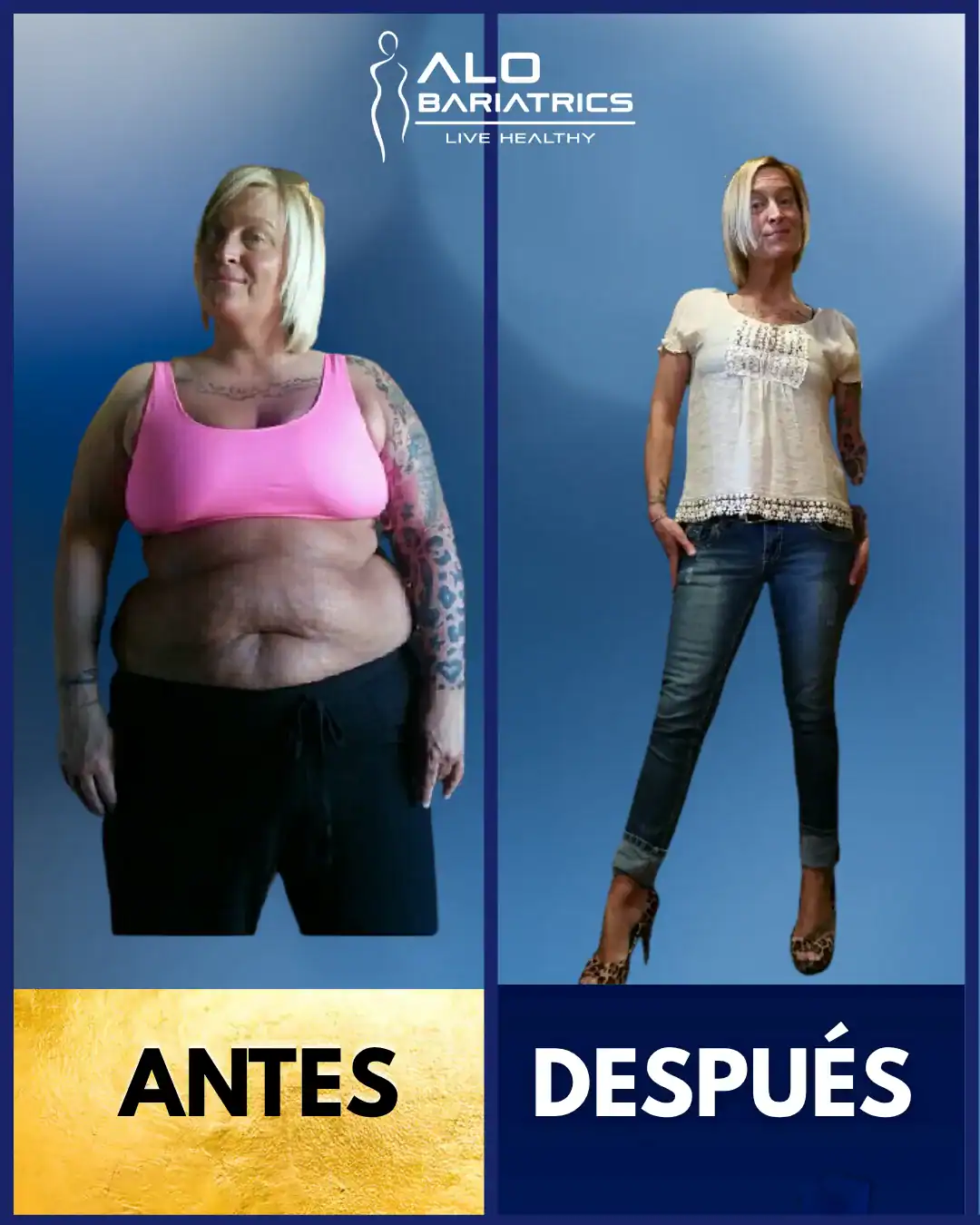 Resultados reales — Puerto Vallarta · Dr. Alejandro López